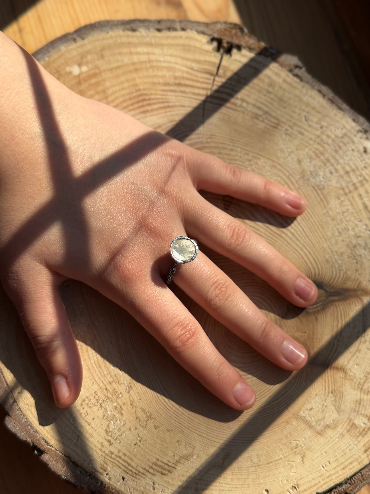 molten cup ring on hand
